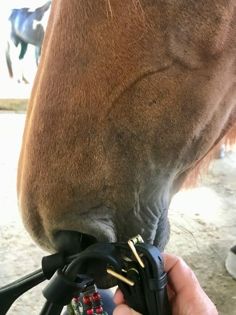 healing the bridle pattern 